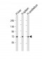 SLC5A4 Antibody (C-term)